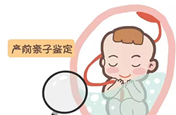 浙江省孕期亲子鉴定如何做，浙江省产前亲子鉴定中心电话地址在哪里